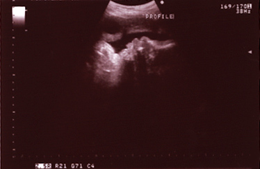 Jack 36 Week Ultrasound